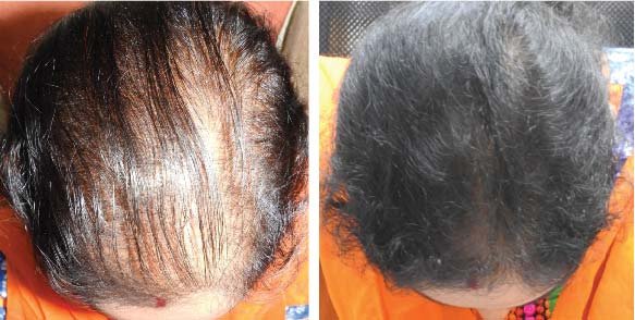 Life Changing Results 05