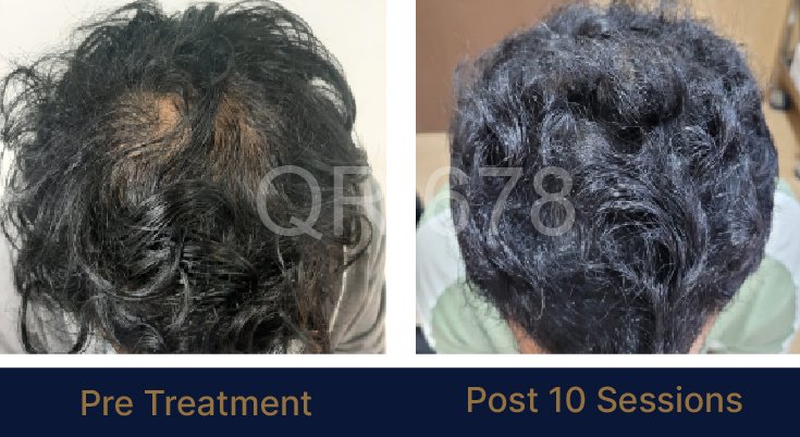 QR678_WEBSITE_BEFORE AFTER_AUG 23-01