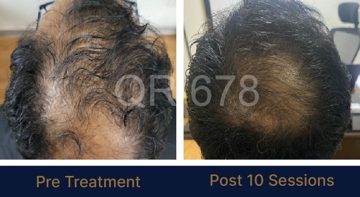 QR678_WEBSITE_BEFORE AFTER_AUG 23-02