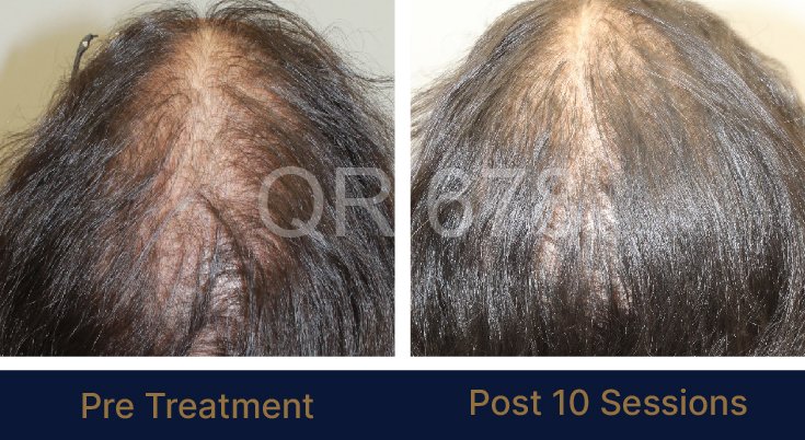 QR678_WEBSITE_BEFORE AFTER_AUG 23-03