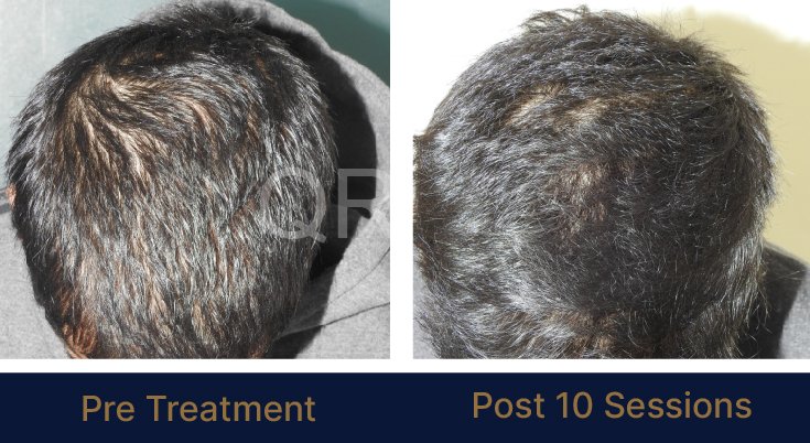 QR678_WEBSITE_BEFORE AFTER_AUG 23-04