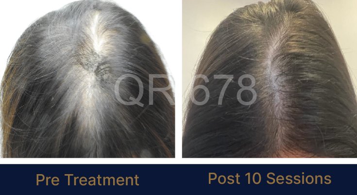 QR678_WEBSITE_BEFORE AFTER_AUG 23-05