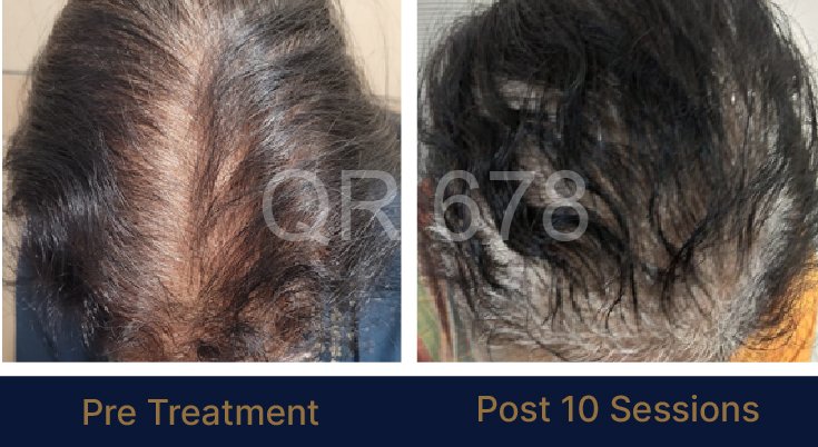QR678_WEBSITE_BEFORE AFTER_AUG 23-07