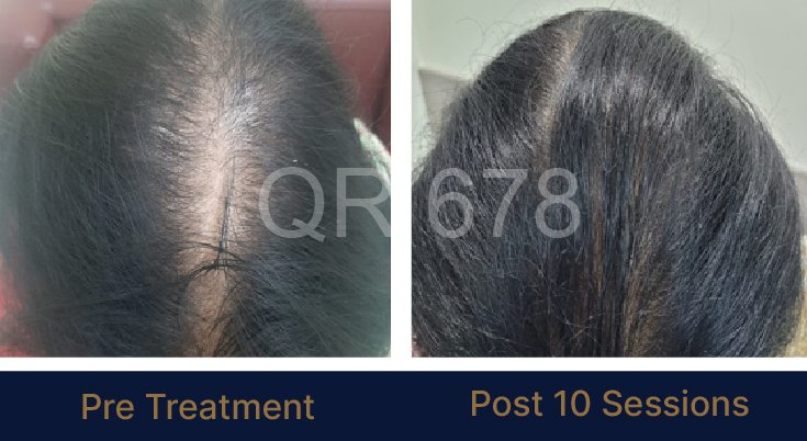 QR678_WEBSITE_BEFORE AFTER_AUG 23-08