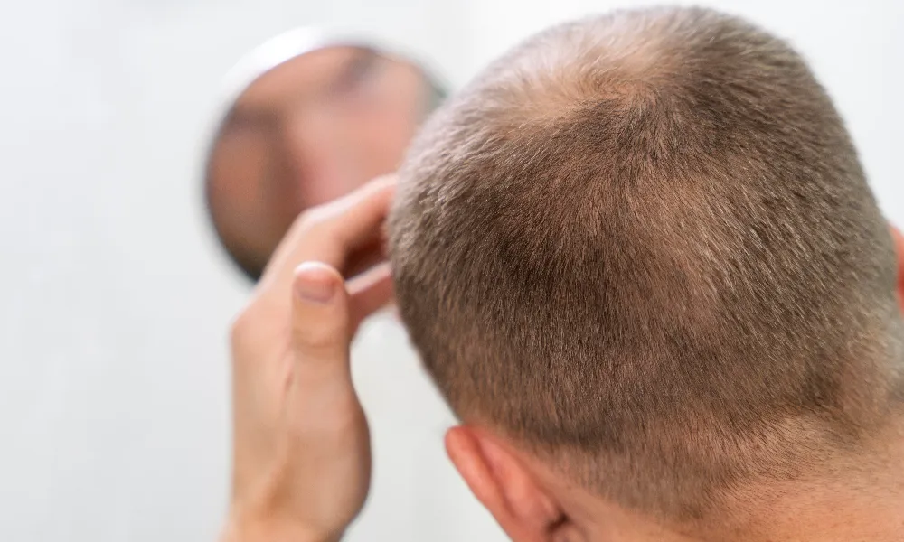 Effective & Best Hair Fall Treatment To Regain Healthy Hair